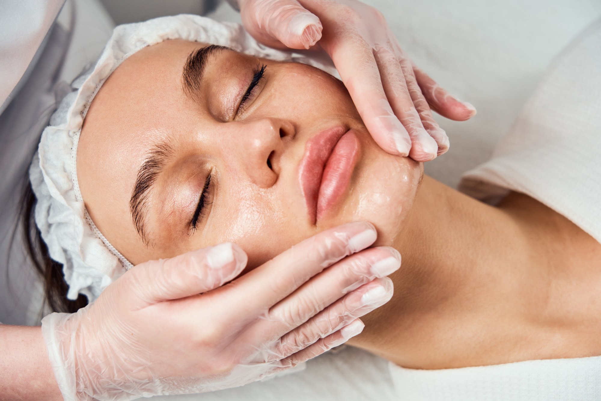 A patient receives a skin moisturizing treatment after CO2 laser treatment in NYC.