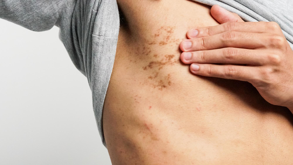 Dark Spots