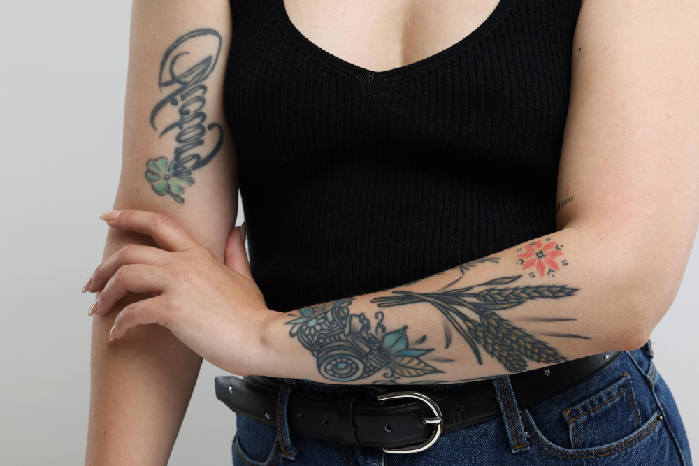 Tattoo Removal